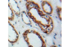 Used in DAB staining on fromalin fixed paraffin-embedded Kidney tissue (TLR3 antibody  (AA 727-905))