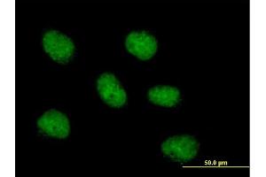 Immunofluorescence of purified MaxPab antibody to MCM10 on HeLa cell.
