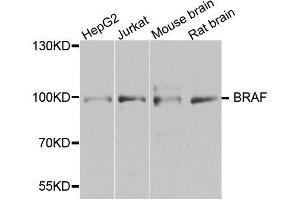 Western blot analysis of extracts of various cell lines, using BRAF antibody. (BRAF antibody  (AA 280-460))