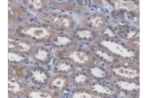 Immunohistochemistry (IHC) image for anti-SNAIL (SNAI1) (AA 1-264) antibody (ABIN7441610)