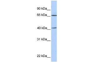 GLA antibody used at 1 ug/ml to detect target protein.