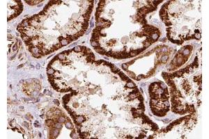ABIN6268779 at 1/100 staining human kidney tissue sections by IHC-P. (Aquaporin 1 antibody  (Internal Region))