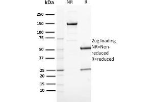 SDS-PAGE Analysis Purified CD163 Mouse Monoclonal Antibody (M130/2164). (CD163 antibody  (AA 43-196))