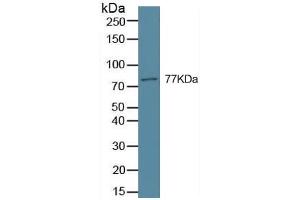 Western Blotting (WB) image for Transglutaminase 2 (C Polypeptide, Protein-Glutamine-gamma-Glutamyltransferase) (TGM2) ELISA Kit (ABIN6574289)