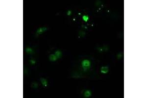 Image no. 3 for anti-CTD (Carboxy-terminal Domain, RNA Polymerase II, Polypeptide A) Small Phosphatase 1 (CTDSP1) antibody (ABIN1497676) (CTDSP1 antibody)