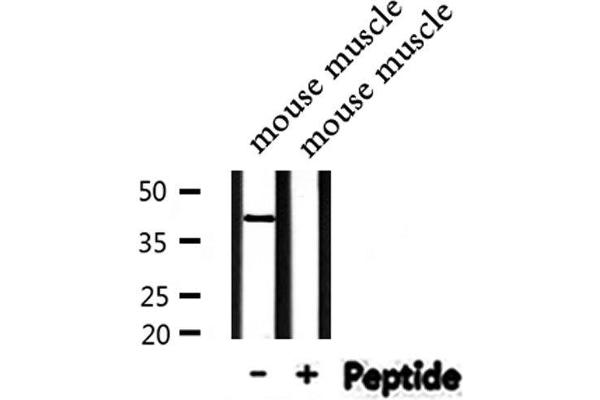 STK36 antibody  (Internal Region)