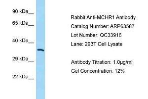 Western Blotting (WB) image for anti-Melanin-Concentrating Hormone Receptor 1 (MCHR1) (N-Term) antibody (ABIN2789557) (MCHR1 antibody  (N-Term))