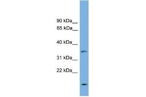 WB Suggested Anti-LIX1L Antibody Titration: 0. (LIX1L antibody  (N-Term))
