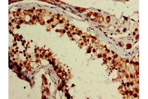 Immunohistochemistry of paraffin-embedded human testis tissue using ABIN7176240 at dilution of 1:100 (ZNF331 antibody  (AA 179-442))
