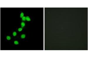 Immunofluorescence analysis of HepG2 cells, using DYR1A Antibody. (DYRK1A antibody  (AA 21-70))