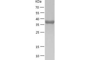 Western Blotting (WB) image for CAMP Responsive Element Binding Protein 3-Like 2 (CREB3L2) (AA 1-378) protein (His tag) (ABIN7122114) (CREB3L2 Protein (AA 1-378) (His tag))