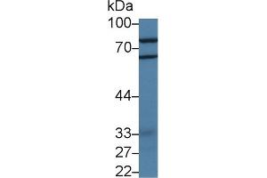 Detection of PADI2 in Porcine Cerebrum lysate using Polyclonal Antibody to Peptidyl Arginine Deiminase Type II (PADI2) (PADI2 antibody)