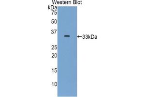 Western Blotting (WB) image for anti-Solute Carrier Family 17 (Acidic Sugar Transporter), Member 5 (SLC17A5) (AA 146-405) antibody (ABIN2907704)