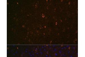 Immunofluorescence analysis of Mouse brain using ABCA2 Polyclonal Antibody at dilution of 1:100 (40x lens).
