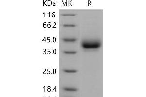 Western Blotting (WB) image for CD209b Antigen (CD209B) protein (His tag) (ABIN7320261) (CD209b Antigen (CD209B) protein (His tag))