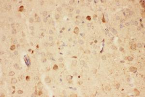 Immunohistochemistry (IHC) image for anti-Heat Shock Protein 90kDa alpha (Cytosolic), Class A Member 1 (HSP90AA1) (AA 2-365) antibody (ABIN3043847)