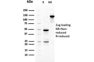 SDS-PAGE Analysis Purified Heregulin-1 Mouse Monoclonal Antibody (NRG1/2710). (Neuregulin 1 antibody  (AA 21-242))