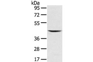 Western Blot analysis of Mouse kidney tissue using VSIG8 Polyclonal Antibody at dilution of 1/400 (VSIG8 antibody)
