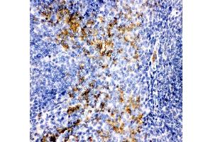 IHC analysis of MCP1/CCL2 using anti-MCP1/CCL2 antibody (ABIN3042598). (CCL2 antibody  (AA 24-99))