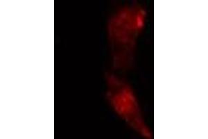 ABIN6274121 staining Hela cells by IF/ICC. (TACC1 antibody  (N-Term))