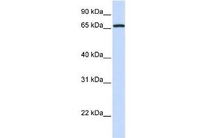 WB Suggested Anti-MED26 Antibody Titration:  0. (MED26 antibody  (N-Term))