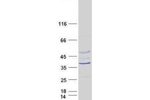 Western Blotting (WB) image for Rhabdoid Tumor Deletion Region Gene 1 (RTDR1) protein (Myc-DYKDDDDK Tag) (ABIN2731235)