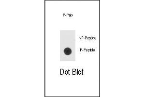 Dot blot analysis of anti-hBad-pS99 Phospho-specific Pab (ABIN389521 and ABIN2850441) on nitrocellulose membrane. (BAD antibody  (pSer99))