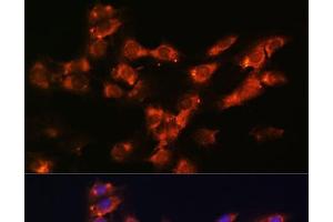 Immunofluorescence analysis of C6 cells using DPP4 Polyclonal Antibody at dilution of 1:100. (DPP4 antibody)