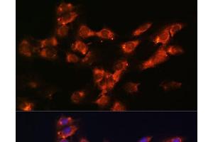 Immunofluorescence analysis of C6 cells using DPP4 Polyclonal Antibody at dilution of 1:100.