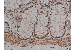 ABIN6268881 at 1/200 staining human colon tissue sections by IHC-P. (Desmin antibody)