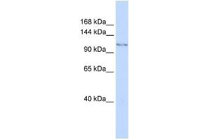 WB Suggested Anti-JHDM1D Antibody Titration: 0. (JHDM1D antibody  (C-Term))