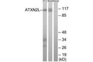 Western blot analysis of extracts from NIH-3T3/RAW264. (Ataxin 2-Like antibody  (AA 571-620))