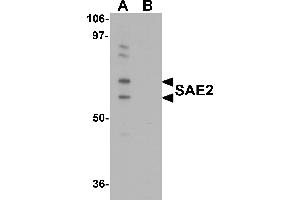 Western Blotting (WB) image for anti-SUMO1 Activating Enzyme Subunit 2 (UBA2) (C-Term) antibody (ABIN1030636) (UBA2 antibody  (C-Term))