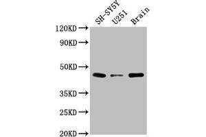 Western Blot Positive WB detected in: SH-SY5Y whole cell lysate, U251 whole cell lysate, Rat brain tissue All lanes: LRTM2 antibody at 1:2000 Secondary Goat polyclonal to rabbit IgG at 1/50000 dilution Predicted band size: 42 kDa Observed band size: 42 kDa (LRTM2 antibody  (AA 36-310))