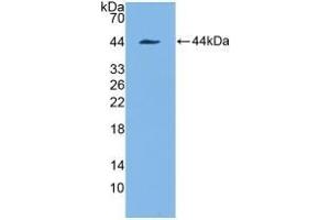 Detection of Recombinant KRT7, Human using Polyclonal Antibody to Cytokeratin 7 (CK7) (Cytokeratin 7 antibody  (AA 91-394))