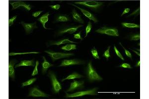 Immunofluorescence of monoclonal antibody to PRC1 on HeLa cell. (PRC1 antibody  (AA 1-620))