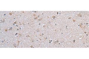 Immunohistochemistry of paraffin-embedded Human brain tissue using CLDN12 Polyclonal Antibody at dilution of 1:45(x200) (Claudin 12 antibody)