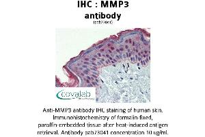 Image no. 1 for anti-Matrix Metallopeptidase 3 (Stromelysin 1, Progelatinase) (MMP3) (AA 1-35) antibody (ABIN1737032)
