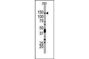Image no. 1 for anti-Phosphoinositide-3-Kinase, Catalytic, delta Polypeptide (PIK3CD) (N-Term) antibody (ABIN360449) (PIK3CD antibody  (N-Term))
