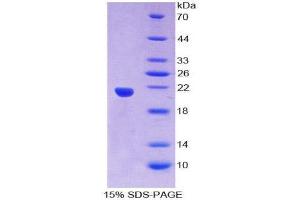 SDS-PAGE (SDS) image for Small Nuclear Ribonucleoprotein Polypeptide C (SNRPC) (AA 2-159) protein (His tag) (ABIN2126799)