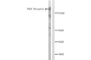 Western blot analysis of extracts from NIH/3T3 cells. (PDGFRB antibody)