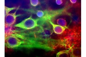 High Magnification view of mixed neuron/glial cultures stained with our MARCKS antibody (red) and CPCA-MAP2, antibody to MAP2 made in chicken. (MARCKS antibody)