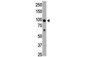 HDAC4 antibody used in western blot to detect HDAC4 in mouse brain tissue lysate (HDAC4 antibody  (AA 1052-1084))