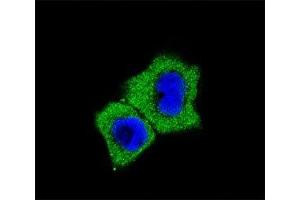 Fluorescent confocal image of A431 cells stained with SMAD7 antibody at 1:25.