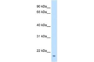 FAM107A antibody used at 0. (FAM107A antibody  (Middle Region))