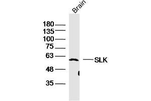 Mouse Brain lysates probed with SLK Polyclonal Antibody, Unconjugated  at 1:300 dilution and 4˚C overnight incubation. (SLK antibody  (AA 165-270))