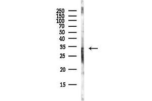 anti-Sulfotransferase Family, Cytosolic, 2A, Dehydroepiandrosterone (DHEA)-Preferring, Member 1 (SULT2A1) (C-Term) antibody