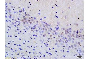 Formalin-fixed and paraffin embedded rat brain tissue labeled with Anti phospho-MAP3K9+MAP3K10(Thr312+Thr266) Polyclonal Antibody, Unconjugated  at 1:200 followed by conjugation to the secondary antibody and DAB staining