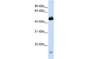 WB Suggested Anti-KCMF1 Antibody Titration:  0. (KCMF1 antibody  (C-Term))