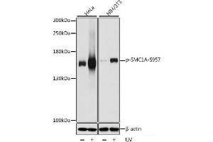 Western blot analysis of extracts of various cell lines using Phospho-SMC1A(S957) Polyclonal Antibody at dilution of 1:1000. (SMC1A antibody  (pSer957))